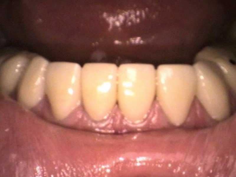 After • Dentist in Hialeah