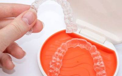 Does Invisalign work for everyone?