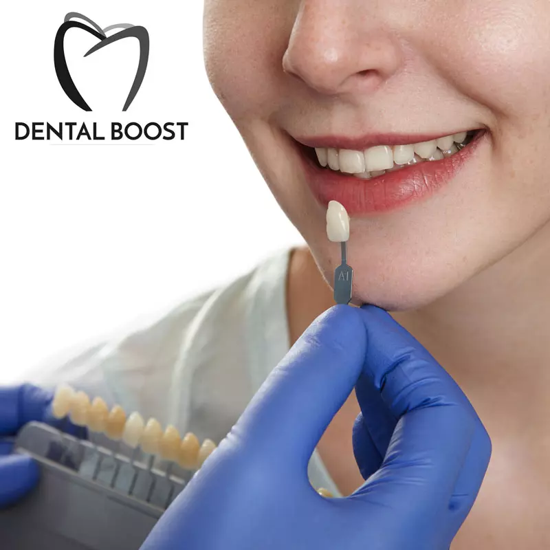 color-test-patient-s-teeth-dental-bonding-in-hialeah